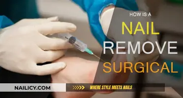 Surgical Nail Removal: Procedure and Aftercare