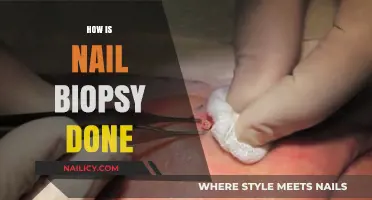 Understanding Nail Biopsy: A Step-by-Step Procedure Guide for Patients