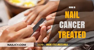 Understanding Nail Cancer Treatment Options and Effective Management Strategies