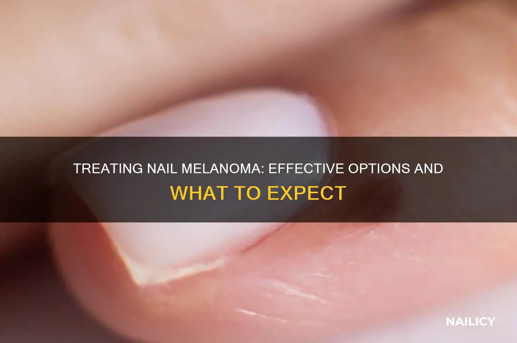 how is nail melanoma treated