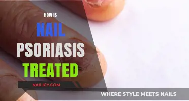 Effective Treatments for Nail Psoriasis: Relief and Management Strategies