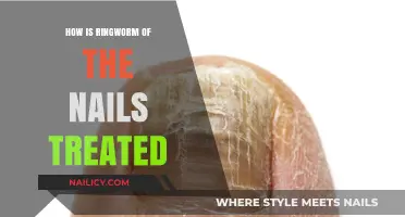 Effective Treatments for Nail Ringworm: Medications, Remedies, and Prevention Tips