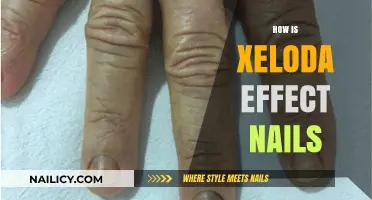 Xeloda Side Effects: Understanding Nail Changes and Management Tips