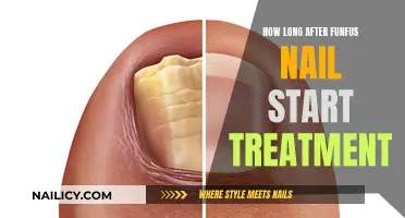 Funfus Nail Treatment: How Long to Recover?