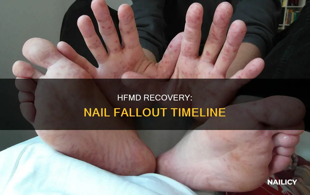 how long after hfmd do nails fall off