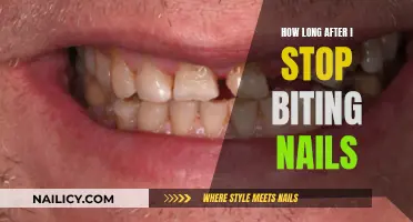 Breaking Nail-Biting Habits: How Long to Recover?