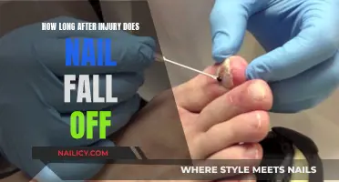Injured Nails: When to Expect Shedding