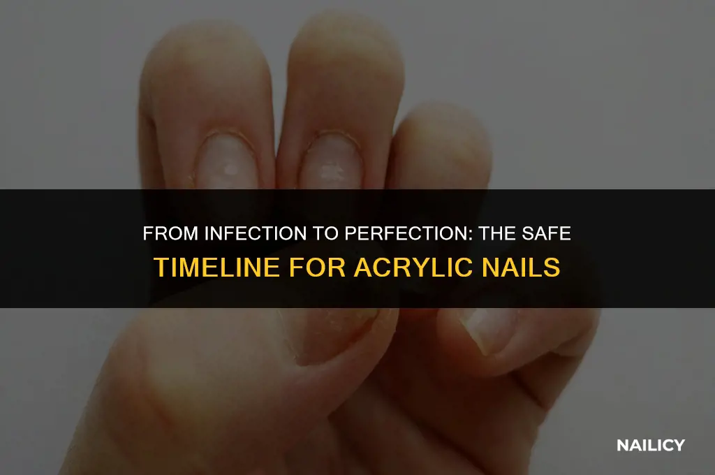 how long after nail infection can i get acrylic nails