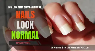 When Will Nails Recover from Biting?