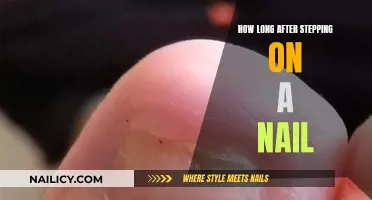 When to Seek Medical Attention After Stepping on a Nail
