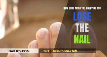 Toe Trauma: Nail Loss Timeline and Treatment