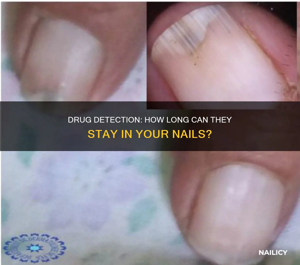 how long are drugs detectable in finger nails