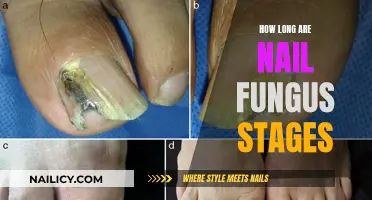 Nail Fungus: Stages and Their Duration