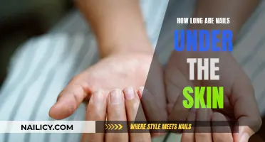 Nails: How Long Do They Stay Under the Skin?