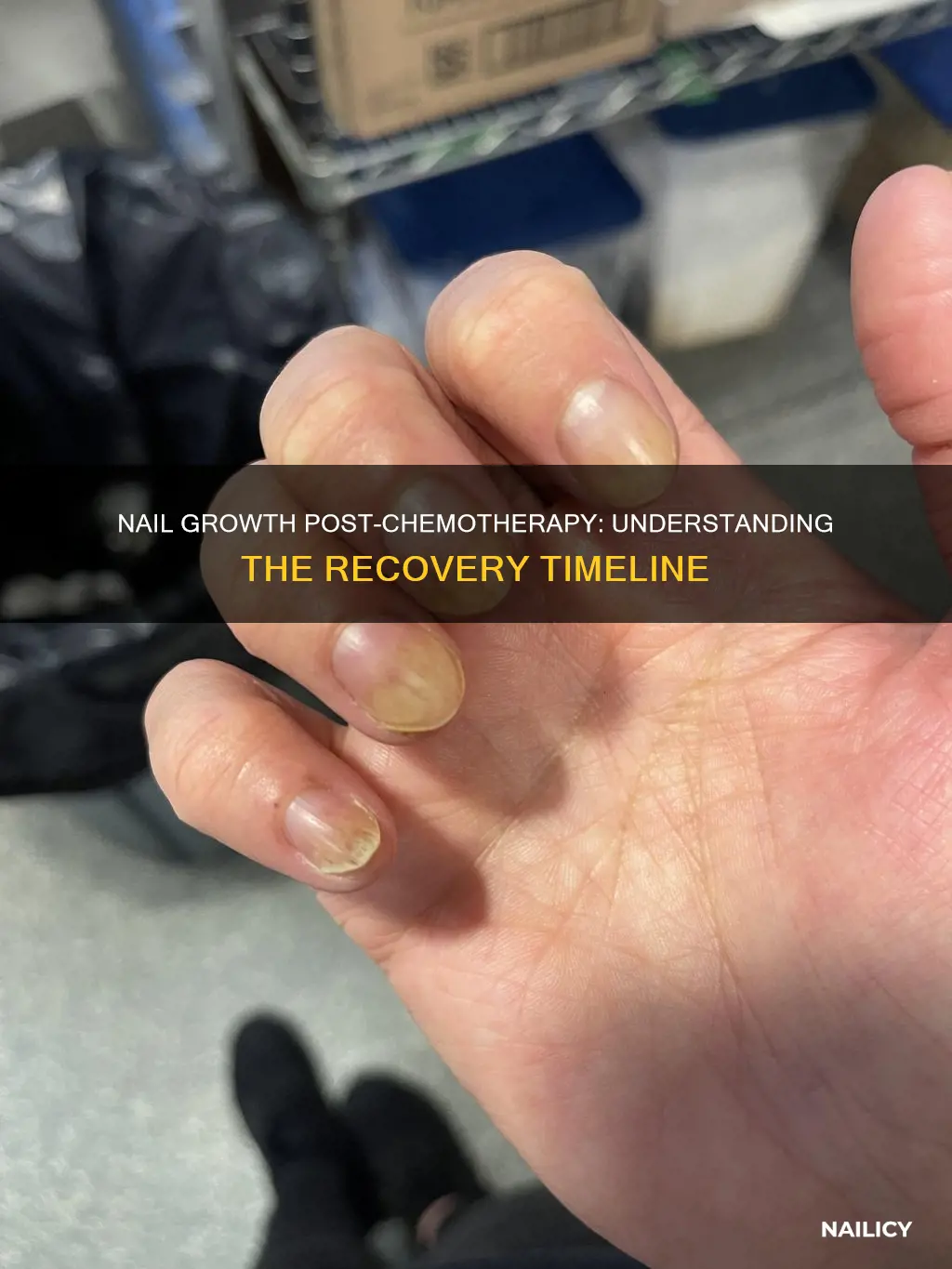 how long before finger nails normal post chemo