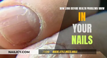 Your Nails: A Window to Your Health