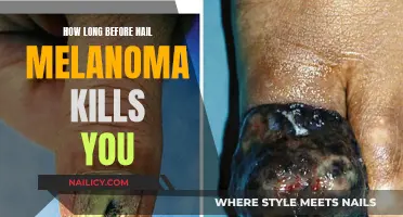Nail Melanoma: Understanding the Prognosis and Survival Rates