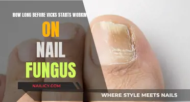 Vicks for Nail Fungus: How Long Till It Works?