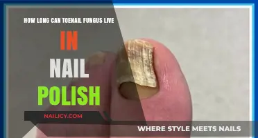 Toenail Fungus Survival: How Long Does It Live in Nail Polish?