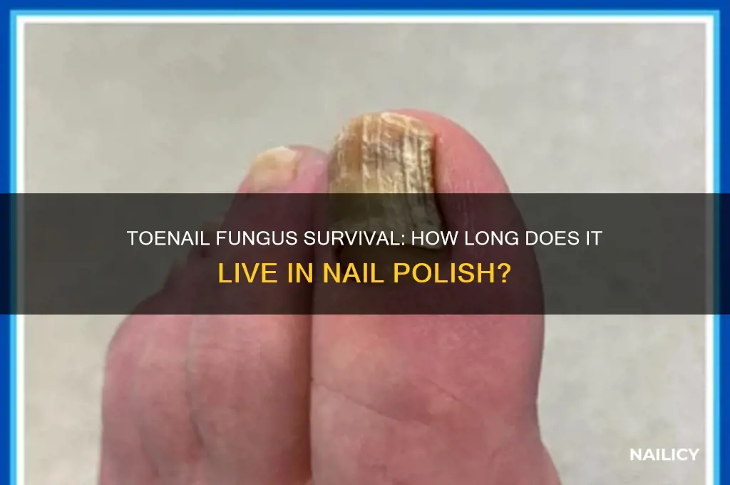 how long can toenail fungus live in nail polish