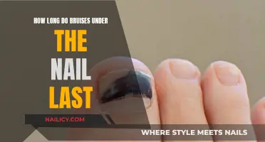 Understanding Bruises Under Nails: Healing Timeline