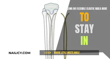Flexible Elastic Nails: How Long Should You Keep Them On?