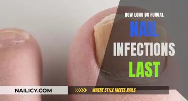 Battling Nail Fungus: How Long Will It Last?