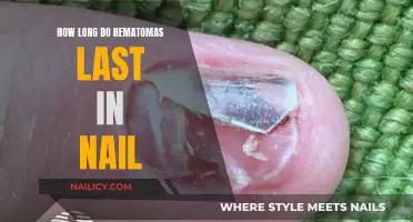 Understanding Hematomas: Nail Recovery Timeline