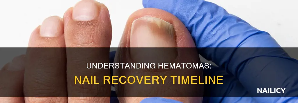 how long do hematomas last in nail