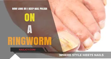 Nail Polish on Ringworm: Duration and Effectiveness Explained