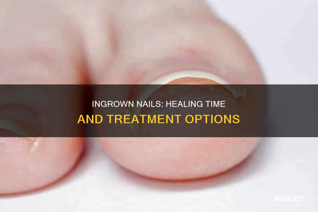 how long do ingrown nails take to heal