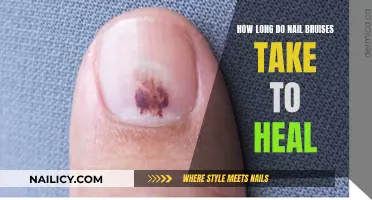 Nail Bruises: Healing Time and Treatment Options