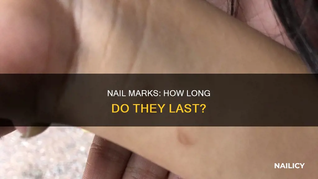 how long do nail marks last