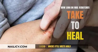 Healing Nail Scratches: Time and Recovery Process