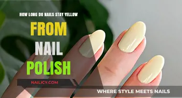 Why Nails Stay Yellow After Polish: Causes and Solutions
