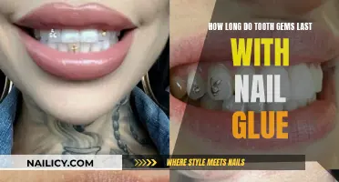 Tooth Gems: How Long Do They Last with Nail Glue?