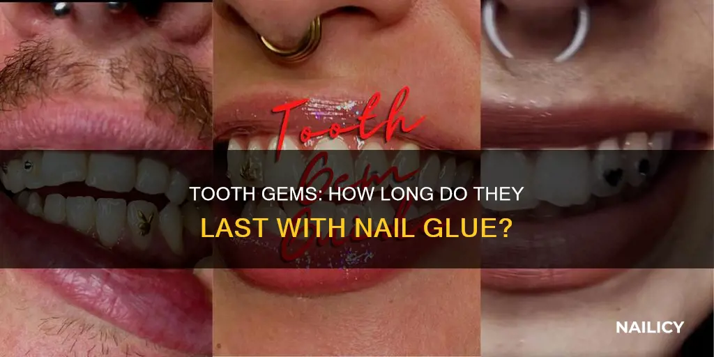 how long do tooth gems last with nail glue