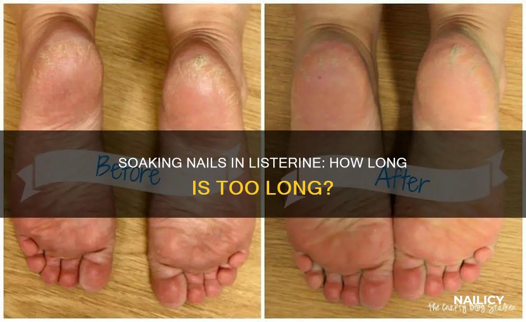 how long do u soak nails in listerine