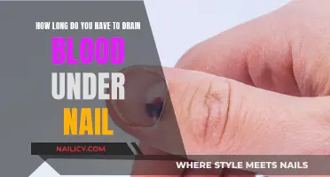 Draining Blood Under Nail: How Long is Too Long?