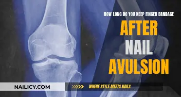 Nail Avulsion: Post-Surgery Bandage Care Duration