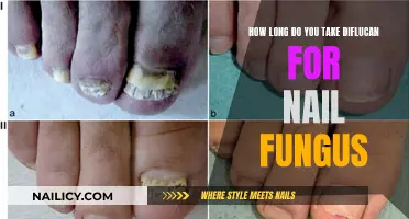 Diflucan Treatment for Nail Fungus: How Long Does It Take?