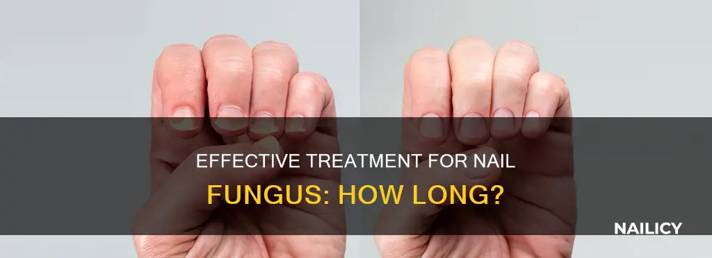 how long do you treat nail fungus