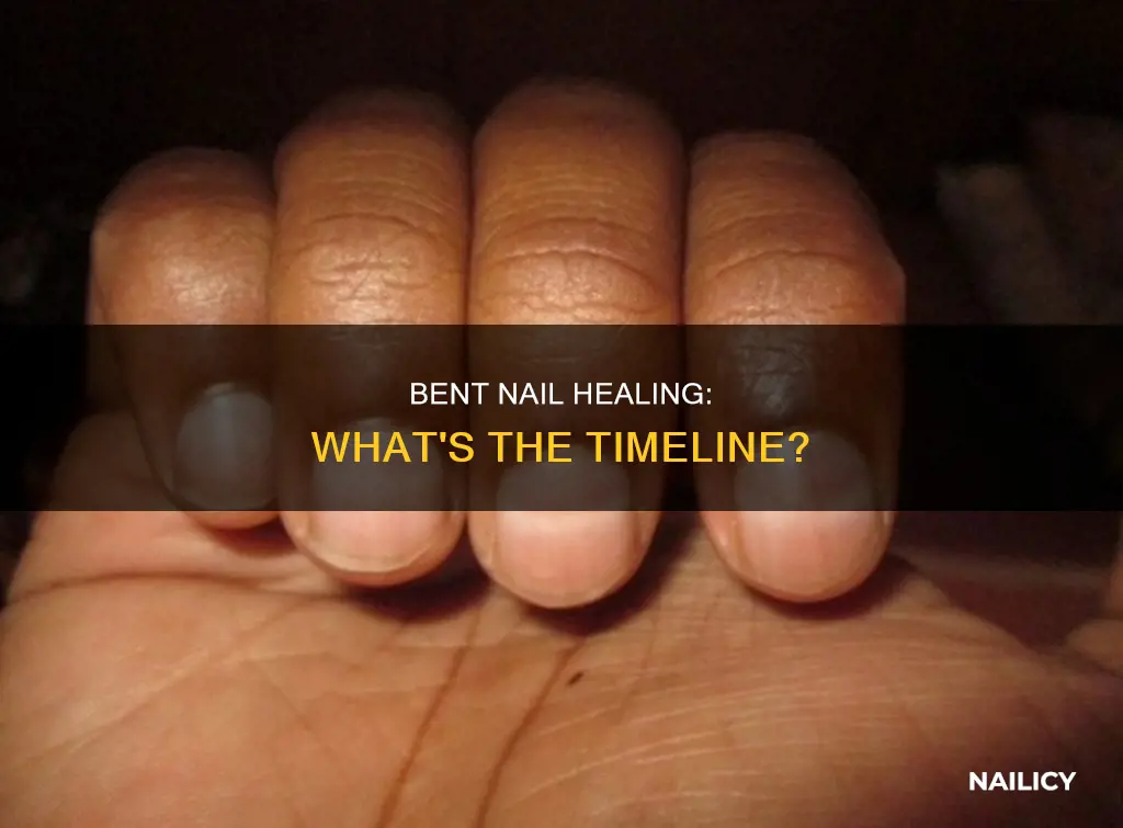 how long does a bent nail take to heal