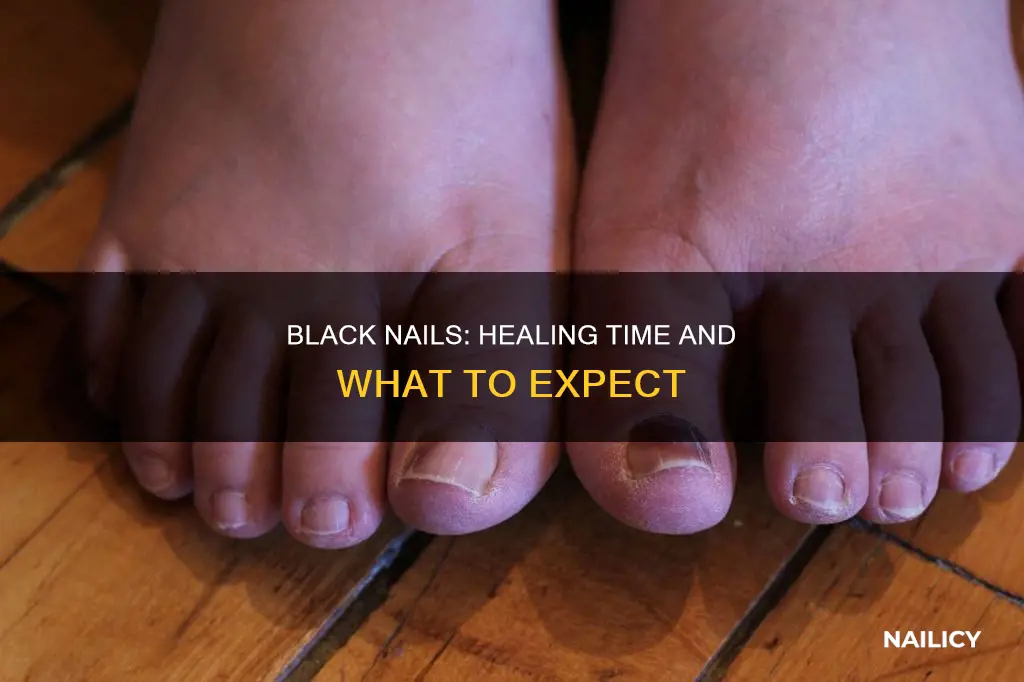 how long does a black nail take to go away
