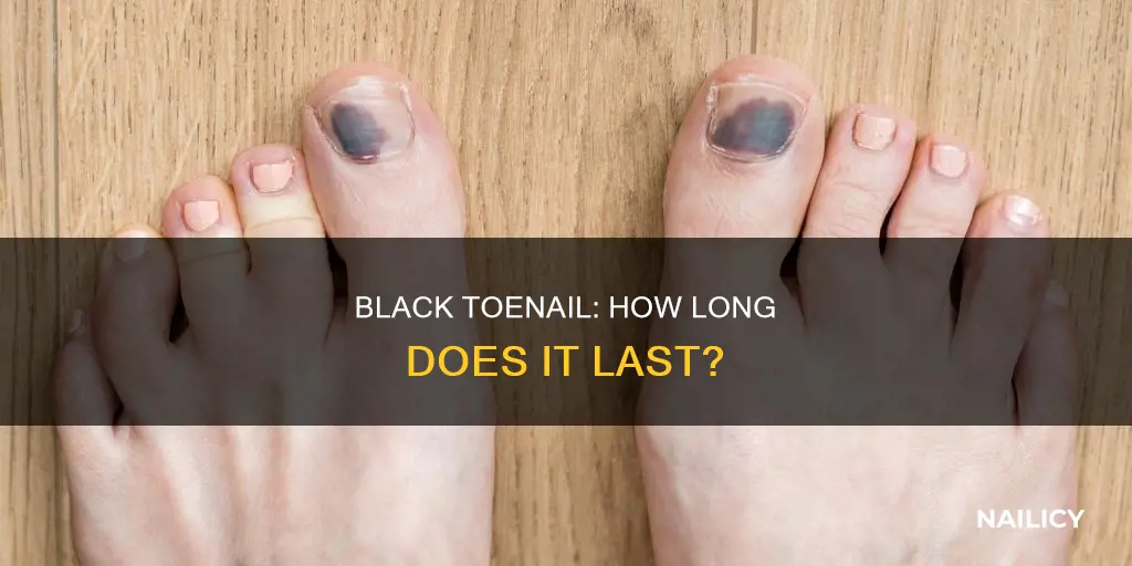 how long does a black toe nail last