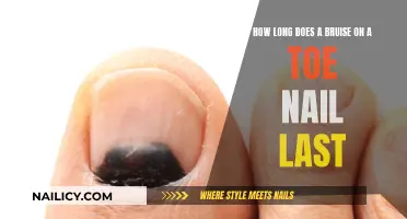 Toe Nail Trauma: Bruising and Recovery Time