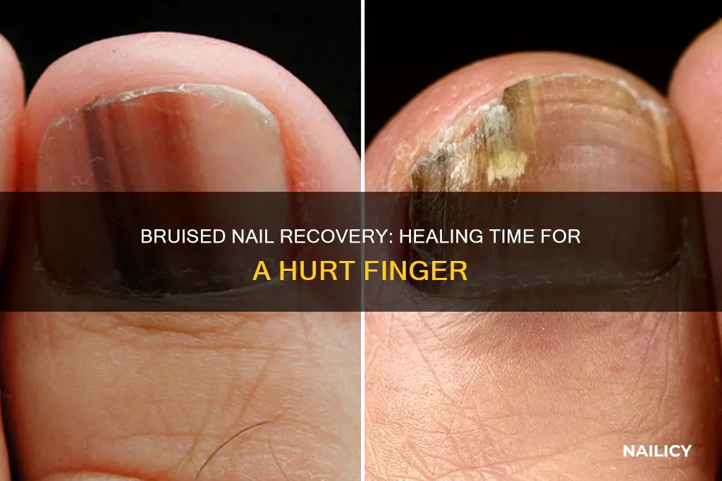 how long does a bruised finger nail take to heal