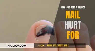 Bruised Nail Pain: How Long Does It Last?
