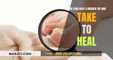 Toe Nail Trauma: Healing a Bruised Toe