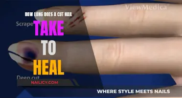 Healing Cut Nails: Time and Tips to Recover
